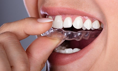 woman with invisalign in yorktown heights ny