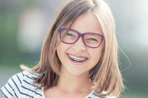 How Much Do Braces Cost Without Insurance?