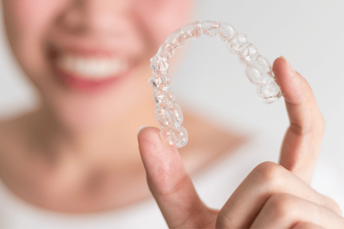 What Are the Benefits of Clear Braces?