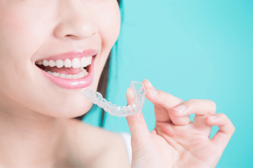 Are Clear Braces Worth It?