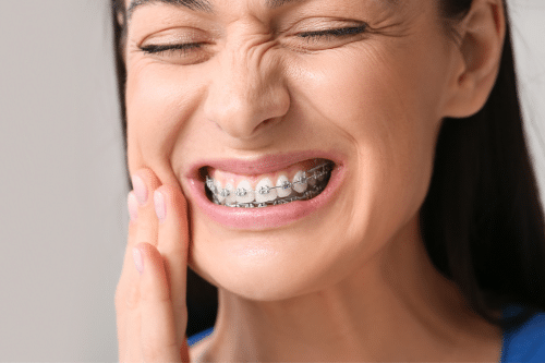 Average Cost of Braces - Best Orthodontist NYC